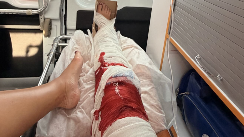 Бузова показала кровавое фото из скорой после падения в душе